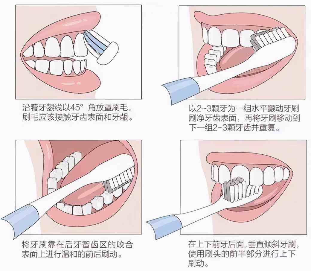 电动牙刷如何使用 |电动牙刷使用方法和技巧