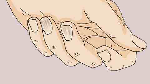 指甲上的竖线是怎么回事(“指甲上的皱纹” 还是疾病的“信号”？)