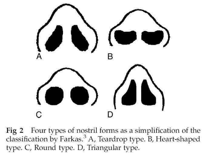 鼻孔过大是因为哪些因素影响形成的？如何改善/修复？