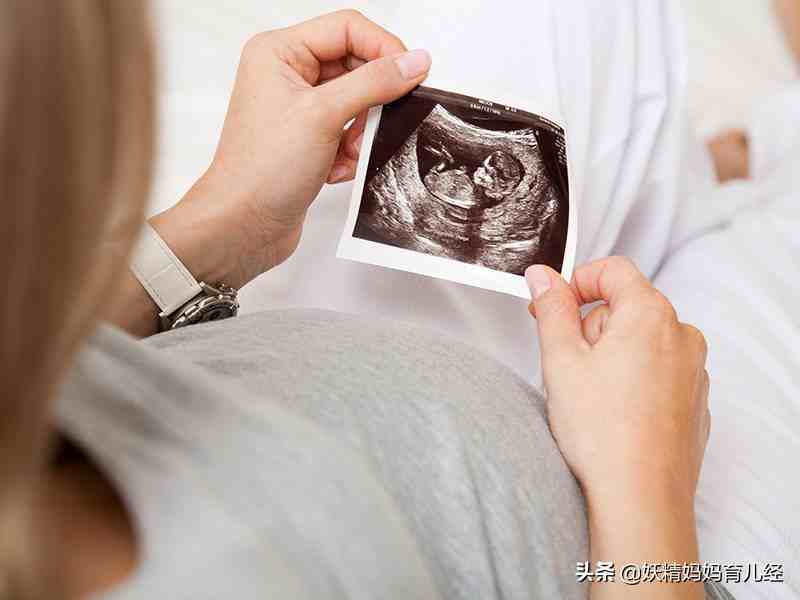 怀孕怎样看男孩女孩;关于5个孕妇体征辨男女的方法