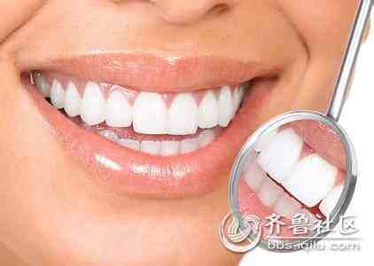 牙齿矫正方法有哪些