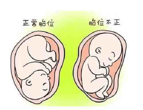 孕期需要注意些什么？