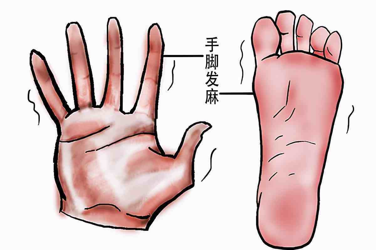 手脚发麻是什么原因（手脚经常发麻和哪些因素有关？）