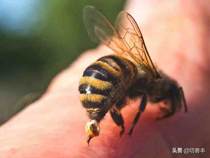 被蜜蜂蛰了怎么处理（被蜂蛰了怎么办？）