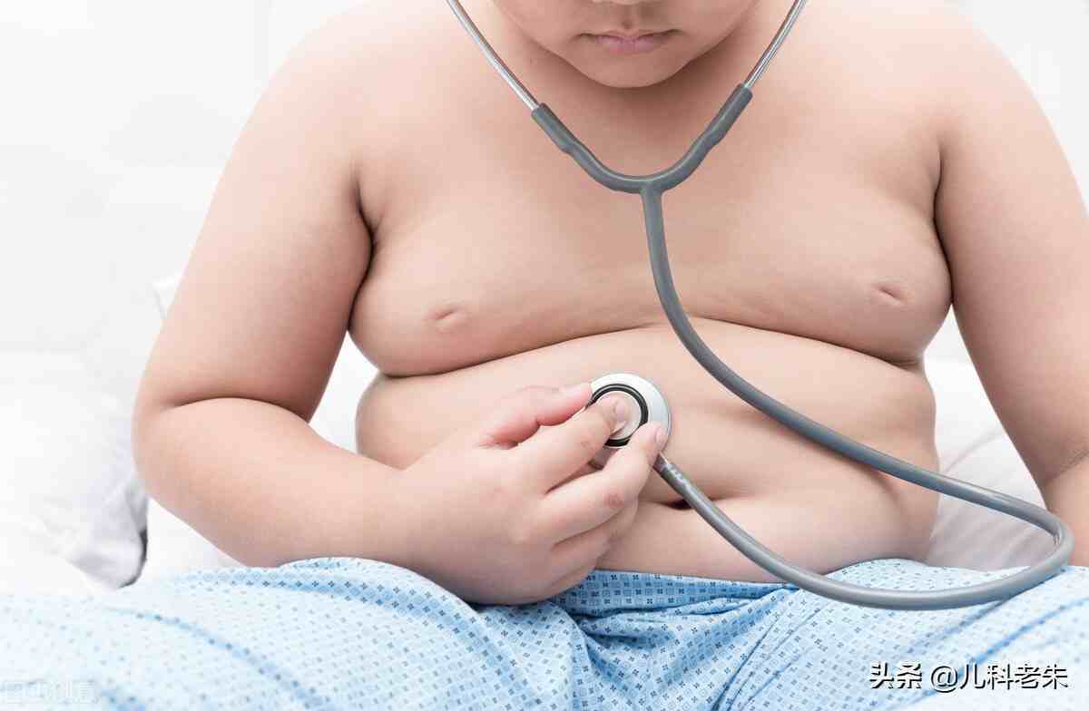 儿童肥胖症（儿童肥胖症是怎么回事？）