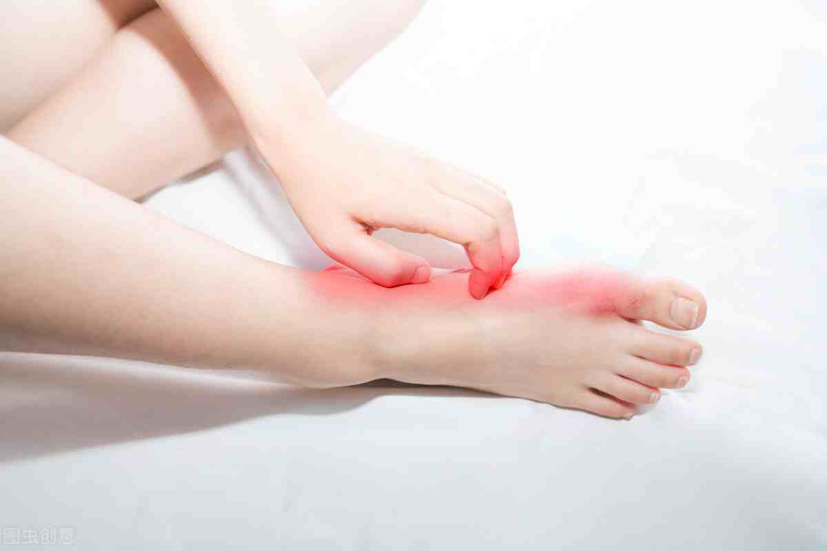 什么是脚气病（引起脚气的病因有哪些？）