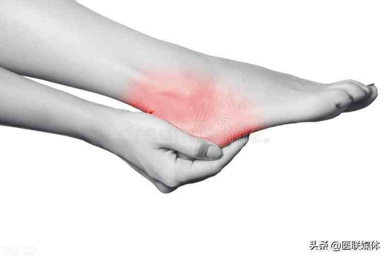女性脚后跟疼痛的原因（脚后跟疼痛是怎么回事？）