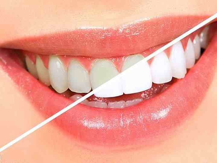 牙粉和牙膏（牙粉和牙膏有什么区别？）