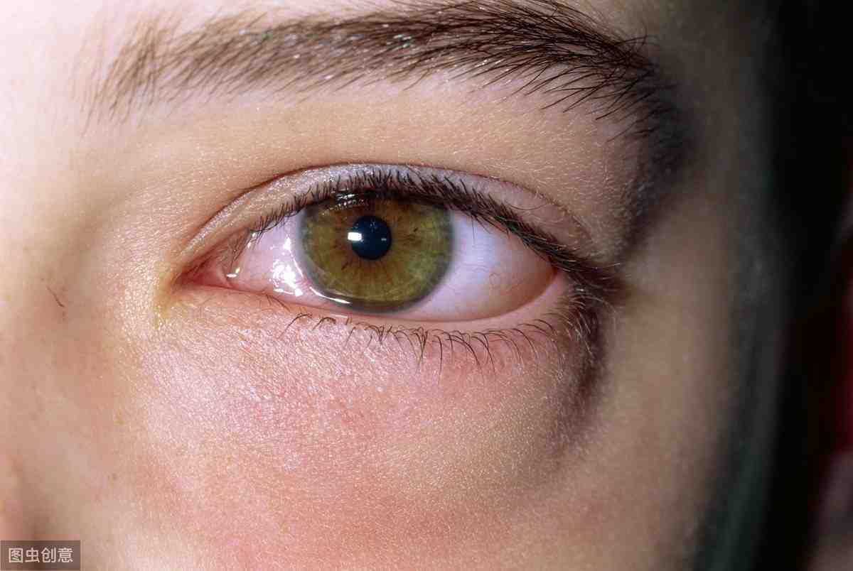 眼睛浮肿的原因（眼睛浮肿是怎么回事？）