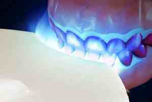 牙黄变白的方法（牙齿发黄是什么原因导致的？）