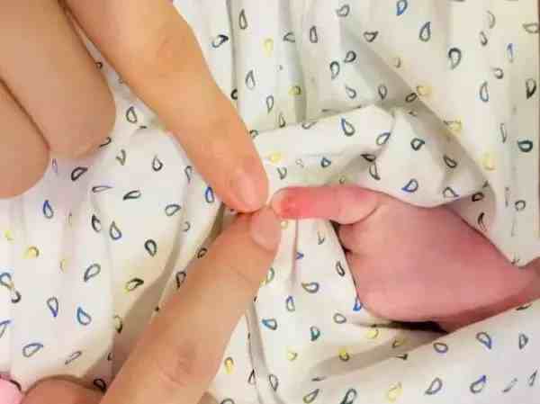 新生儿一天睡多久(八个动作看宝宝脑瘫图)