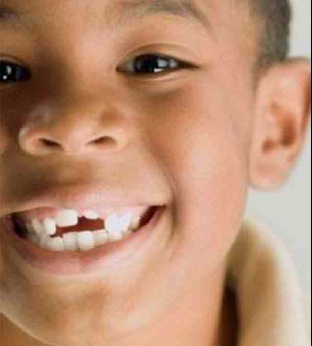 人的牙齿有多少颗(28颗牙齿排列图)