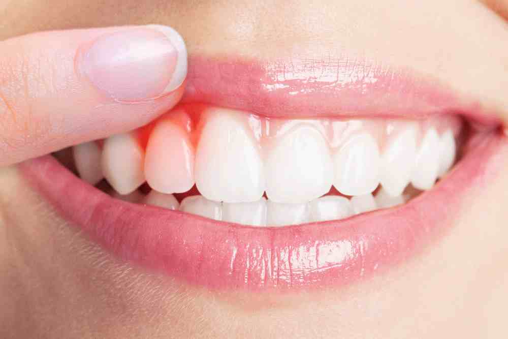 牙缝里总能抠出“臭白泥”？教你一招，刷牙比洗牙都干净