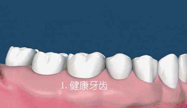 全中国有一半的人都会牙龈萎缩，有这几种症状的要注意了