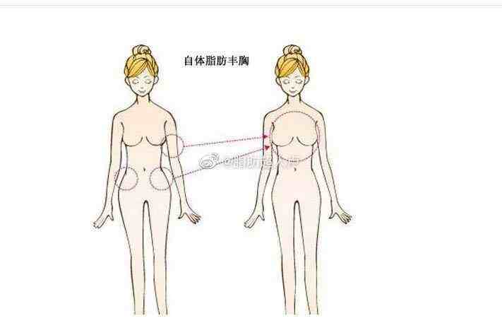 10岁丰胸十七岁图片