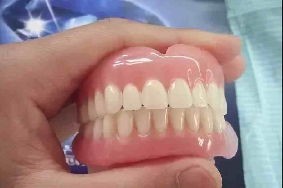「牙齿那些事儿」No.36丨牙齿掉了，是镶牙还是种牙好？