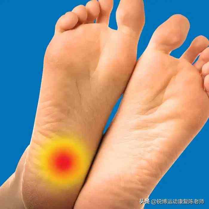 足底疼痛难忍——「足底筋膜炎」全面康复教程