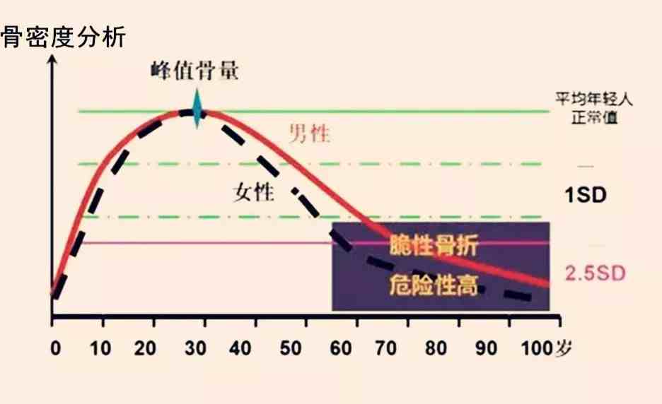 骨密度變化2,看清配料表,選對鈣劑鈣劑好不好,一看含量,二看吸收量,三