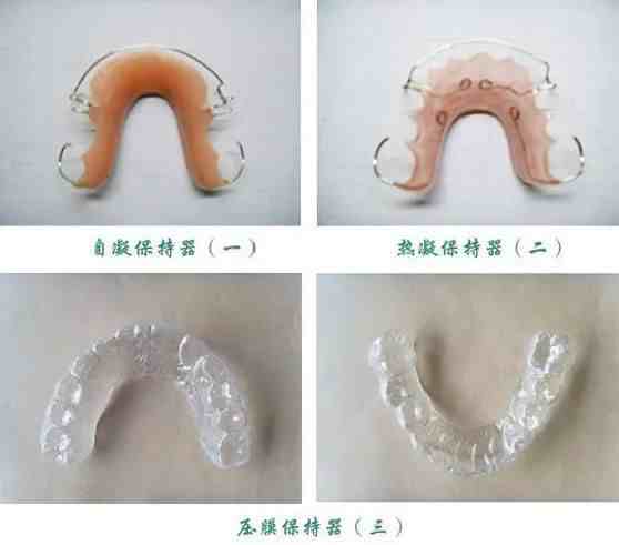 大连齿医生口腔科普 牙齿矫正流程，你知道吗？