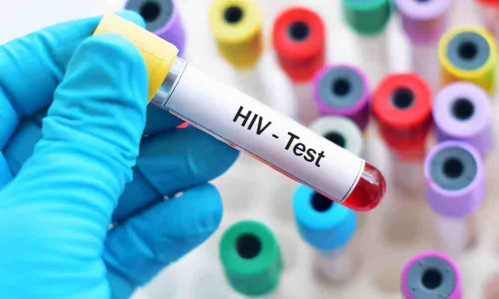 为什么“男同”更容易患HIV？