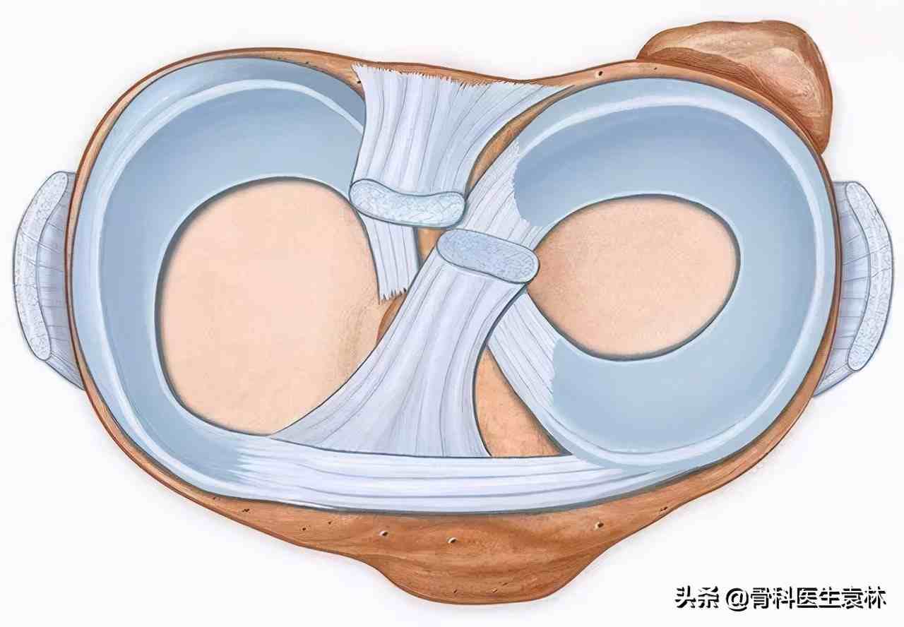 半月板損傷多久能恢復半月板損傷是不是好不了