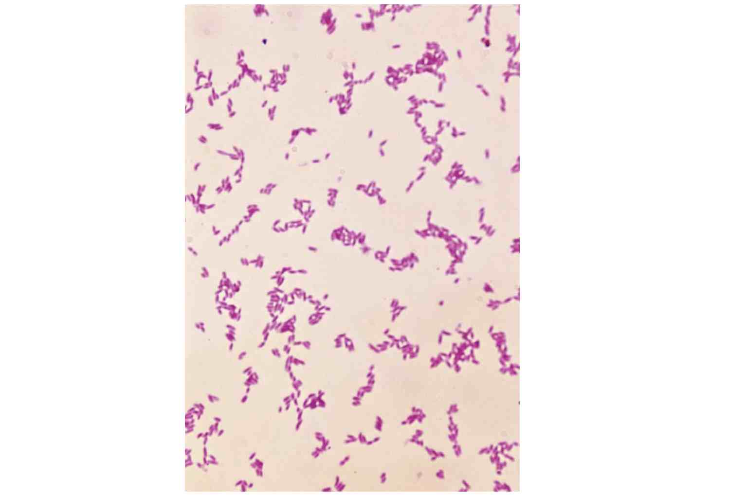 鼠疫耶尔森菌培养图片