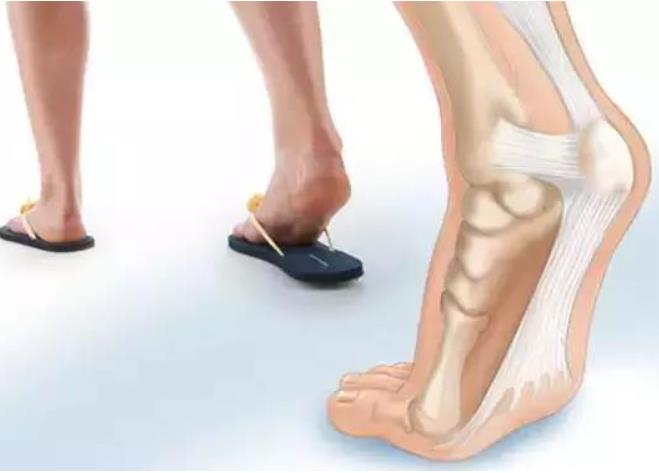 足底痛点的准确位置图_足底疼痛对应身体的疾病_