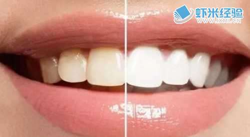 牙齿美白能变白吗__牙齿美白好嘛