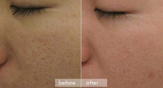 改善皮肤暗沉的方法_改善皮肤的维生素_如何改善皮肤